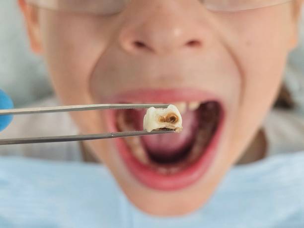 Best Emergency Denture Repair in Prairie Grove, IL